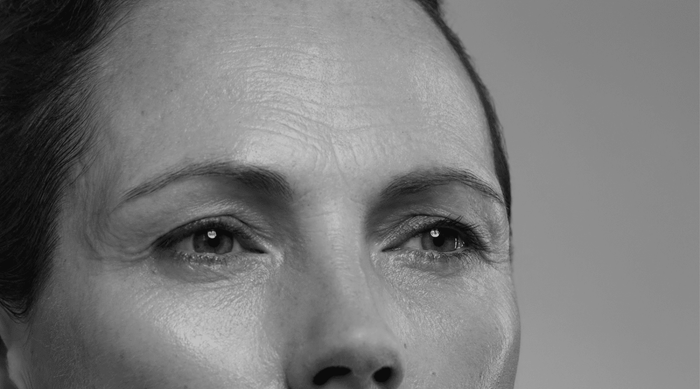 Understanding the Causes of Forehead Wrinkles - QMS Medicosmetics - USA and North America