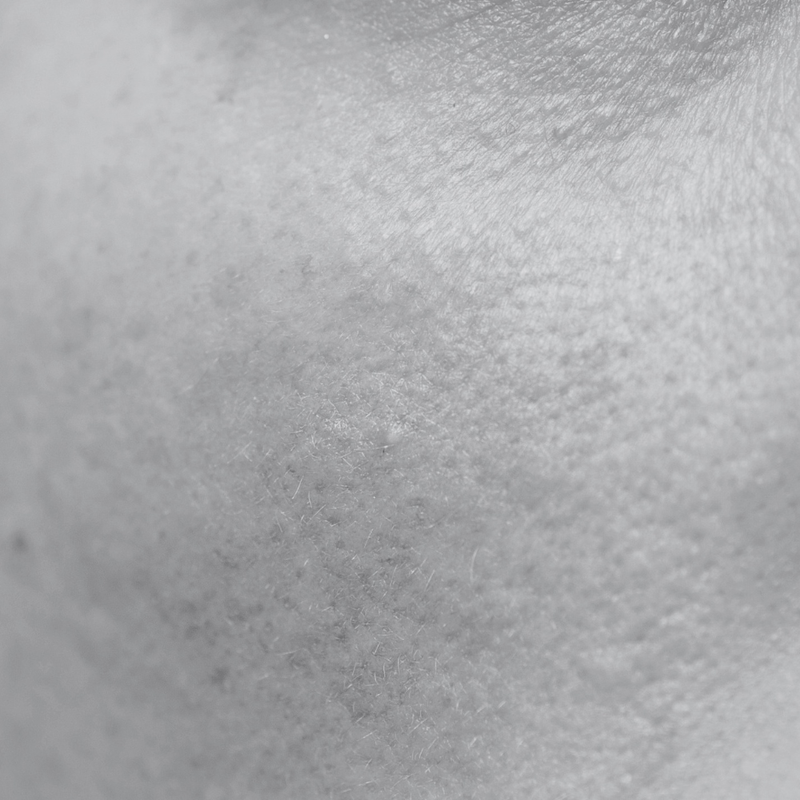 SENSITIVE SKIN